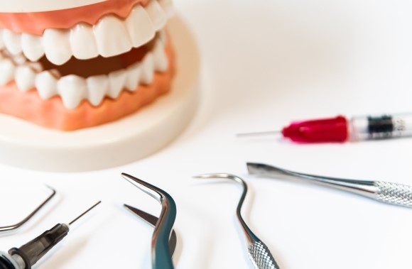 歯科治療の麻酔についての話