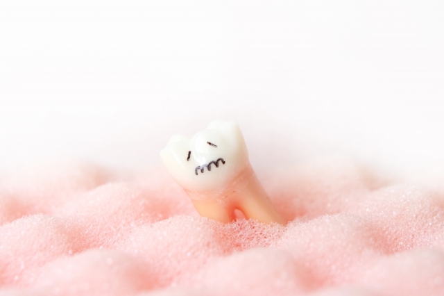 インプラント治療した歯も実は歯周病になるって知ってましたか？？