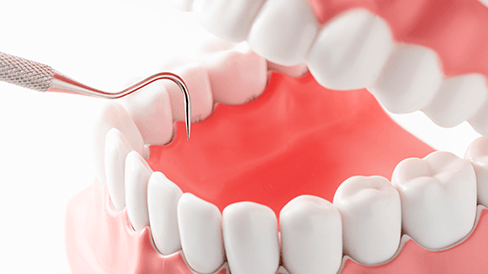 歯周外科について