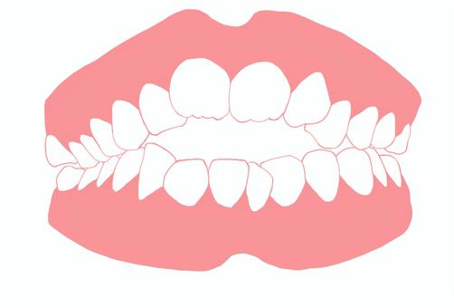 上下の前歯が噛み合わないのはなぜ？放置すると危険な“開咬”の原因と治療法