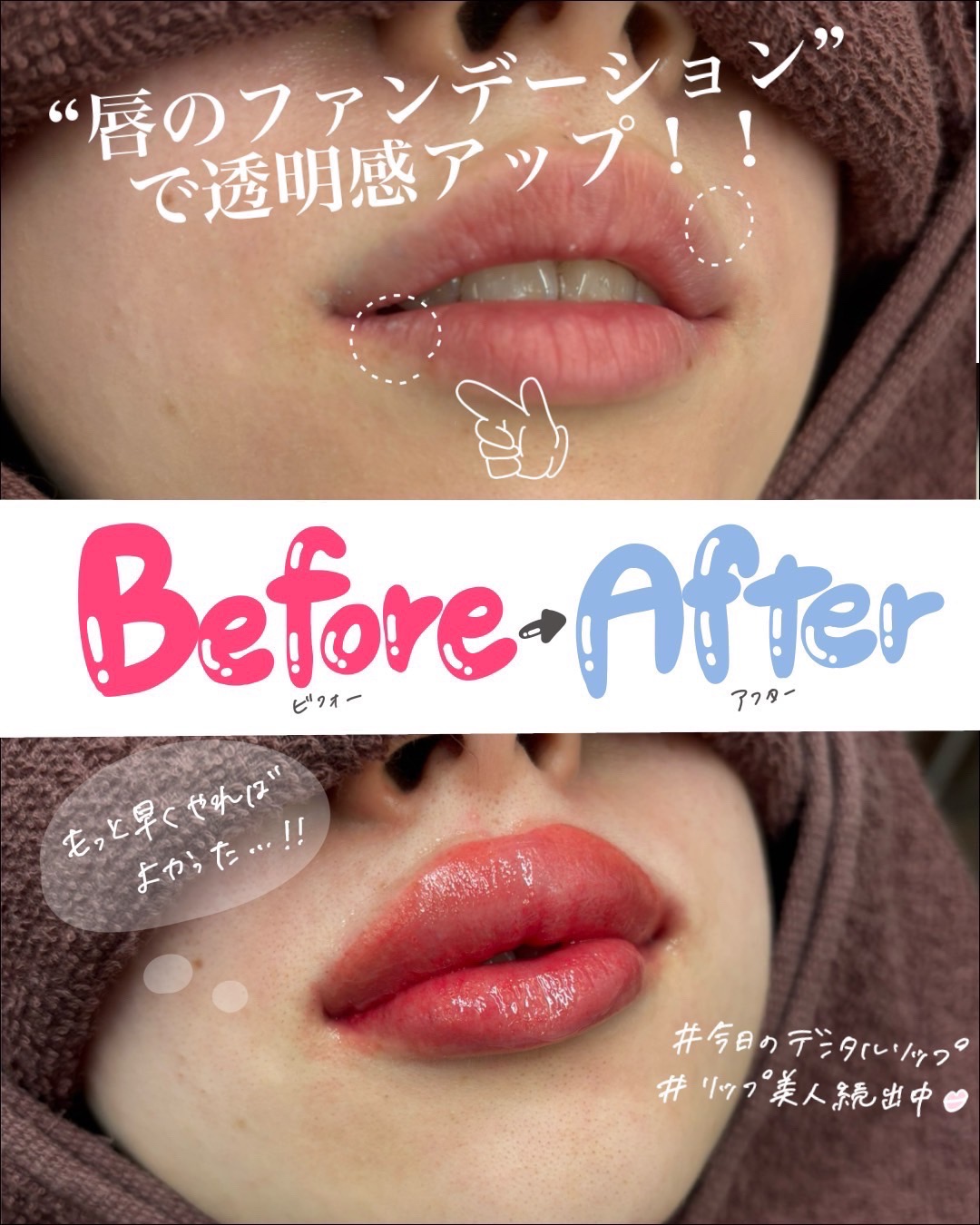 口元の印象が変わる。歯科が行うやさしいリップアートとは