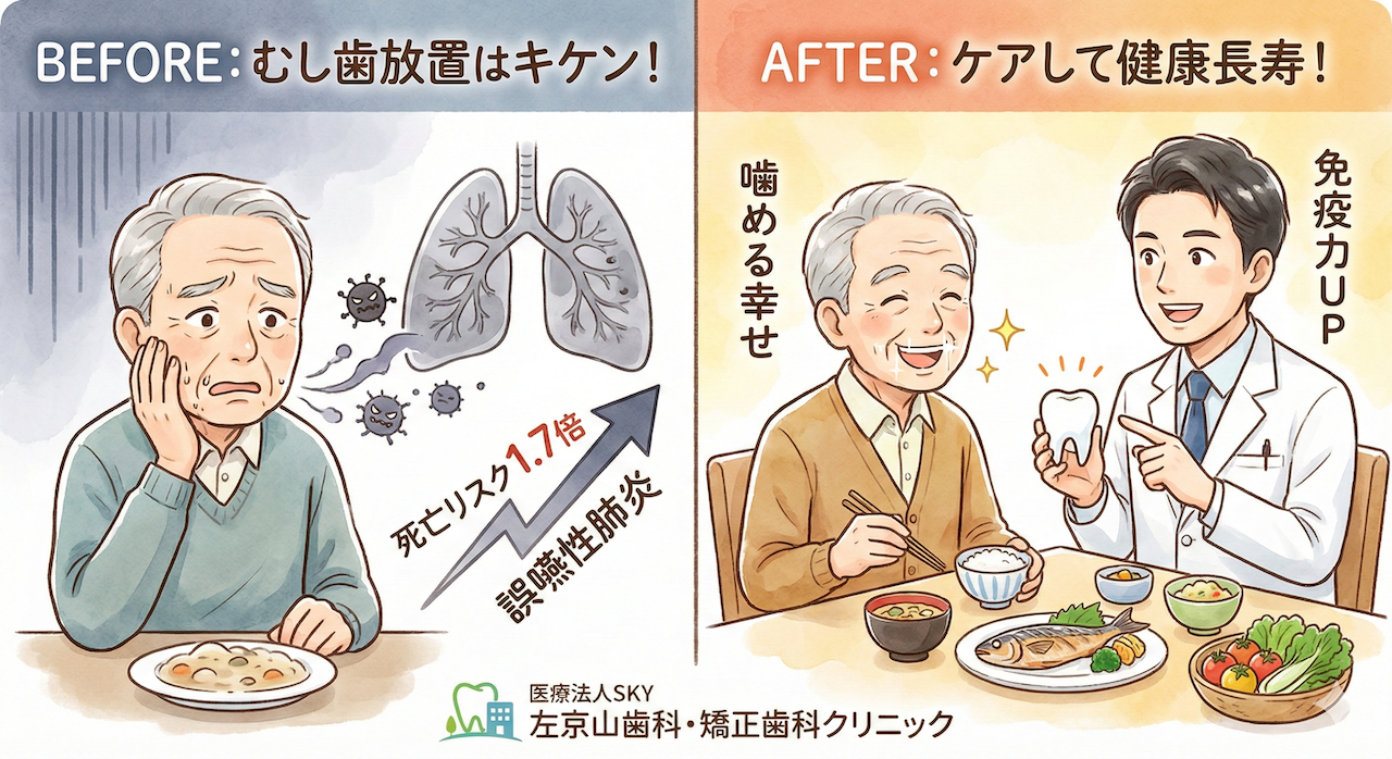 【衝撃】「むし歯放置」で死亡リスク1.7倍!?高齢者の命を守る歯科治療の話
