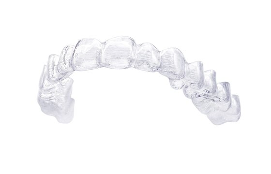 効果が半減することも?マウスピース矯正を成功させるために知っておきたい重要ポイント