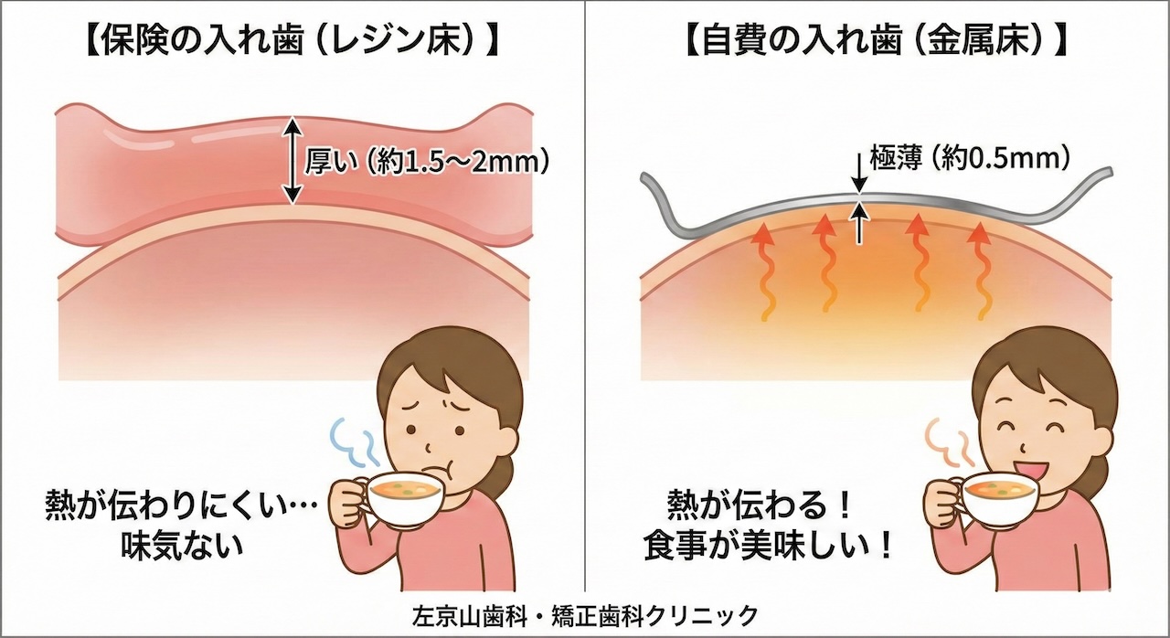 保険の入れ歯で満足できない方へ。薄くて違和感の少ない「金属床義歯」のご紹介