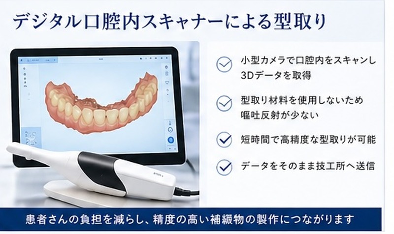 デジタル口腔内スキャナー(PrimeScan)による型取り