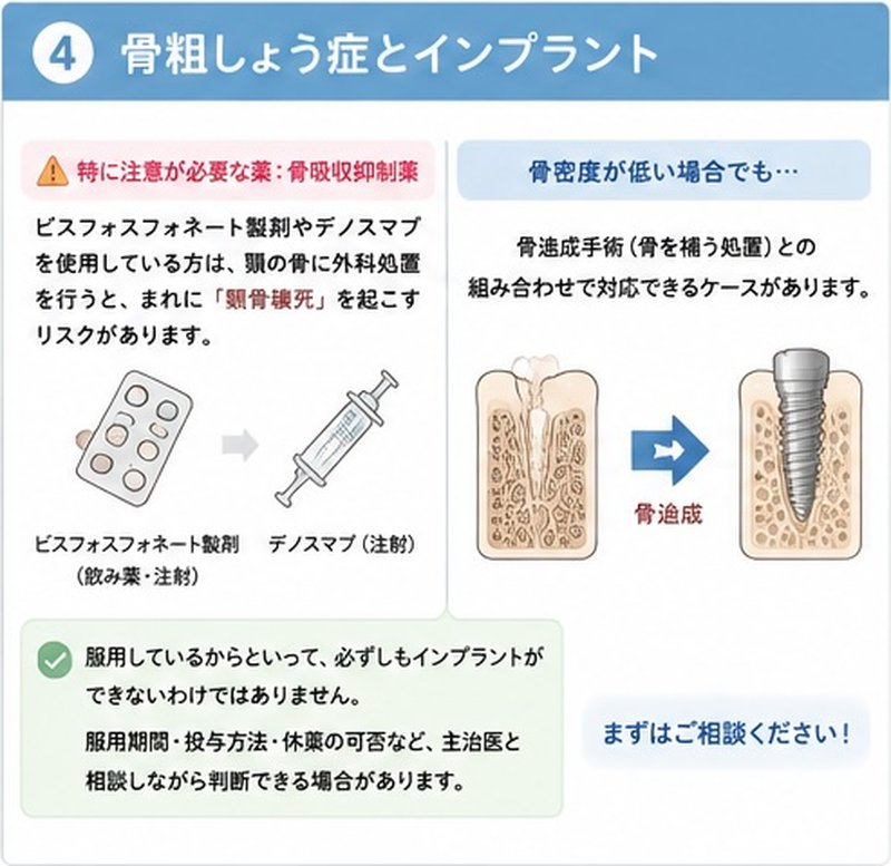 骨粗しょう症とインプラント