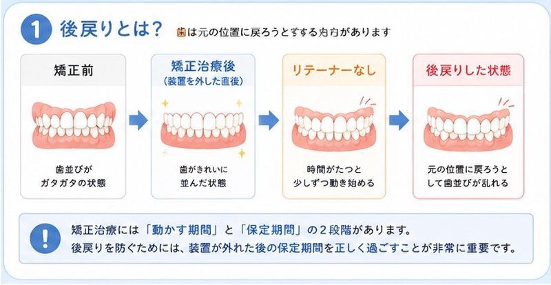 ①後戻りとは?
