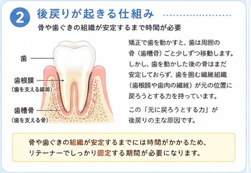②後戻りが起きる仕組み