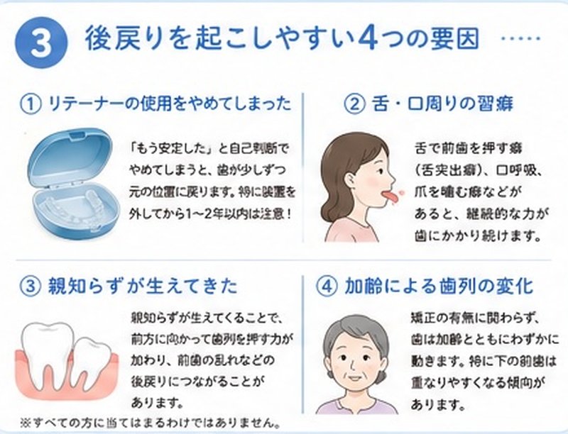 ③後戻りを起こしやすい4つの要因