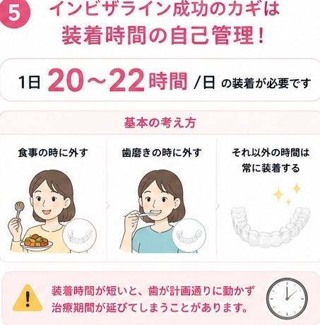 インビザライン成功のカギは装着時間の自己管理