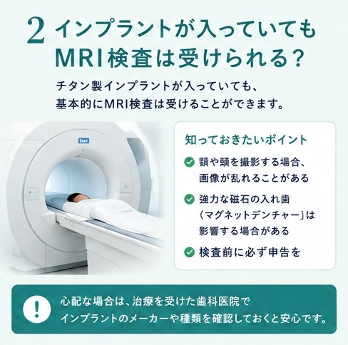 インプラントが入っていてもMRI検査は受けられる?