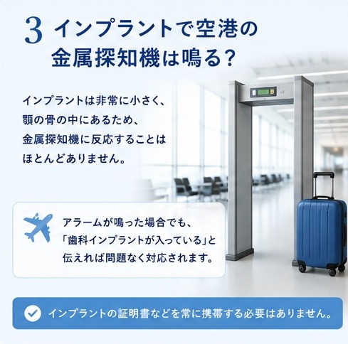 インプラントで空港の金属探知機は鳴る?