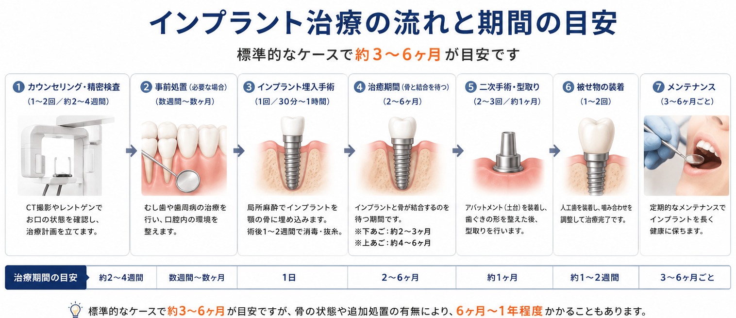 インプラント治療の流れと期間の目安