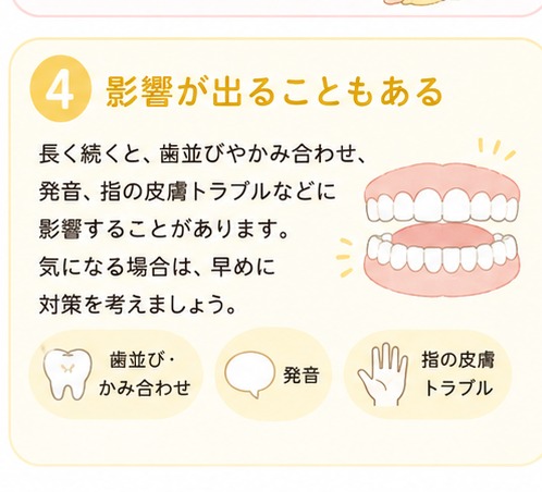 指しゃぶりが歯並びやお口に与える影響