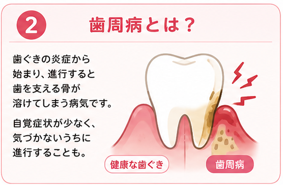 歯周病とは?