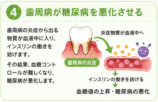 歯周病が糖尿病を悪化させる