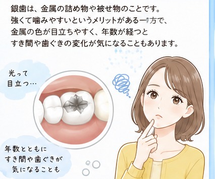 銀歯が気になる理由
