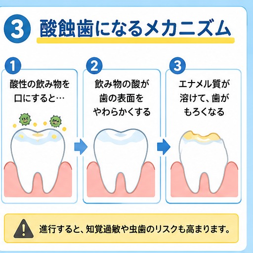 酸蝕歯になるメカニズム