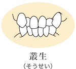 叢生