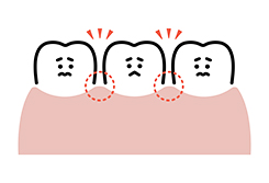 歯と顎の大きさが合わずにすき間ができる