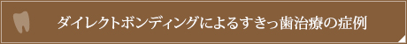 ダイレクトボンディングによるすきっ歯治療の症例