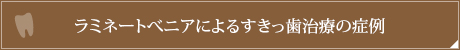 ラミネートべニアによるすきっ歯治療の症例