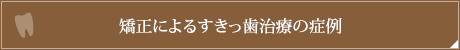 矯正によるすきっ歯治療の症例