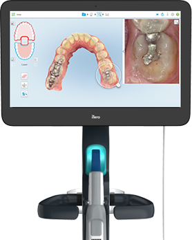 緻密な診断・シミュレーションを実現！口腔内スキャナー「iTero(アイテロ)」を導入しています！